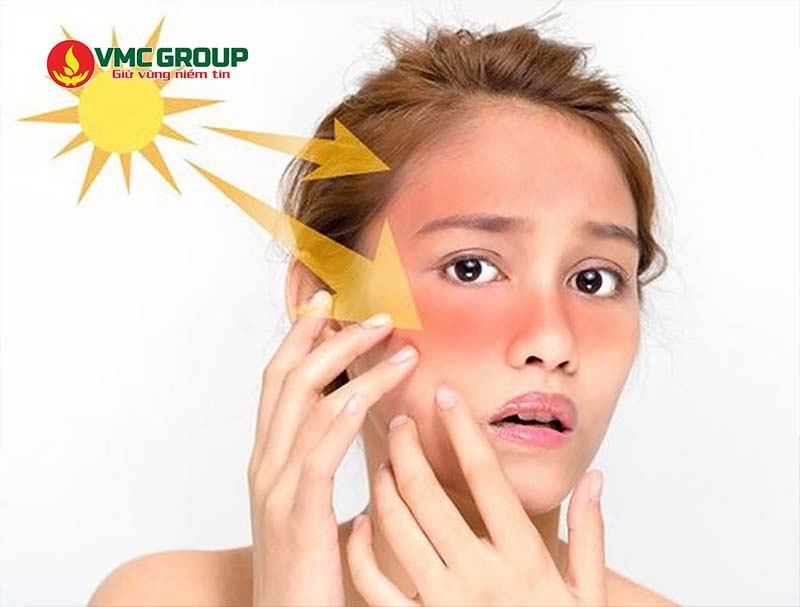 Kẽm oxit giúp chống nắng hiệu quả