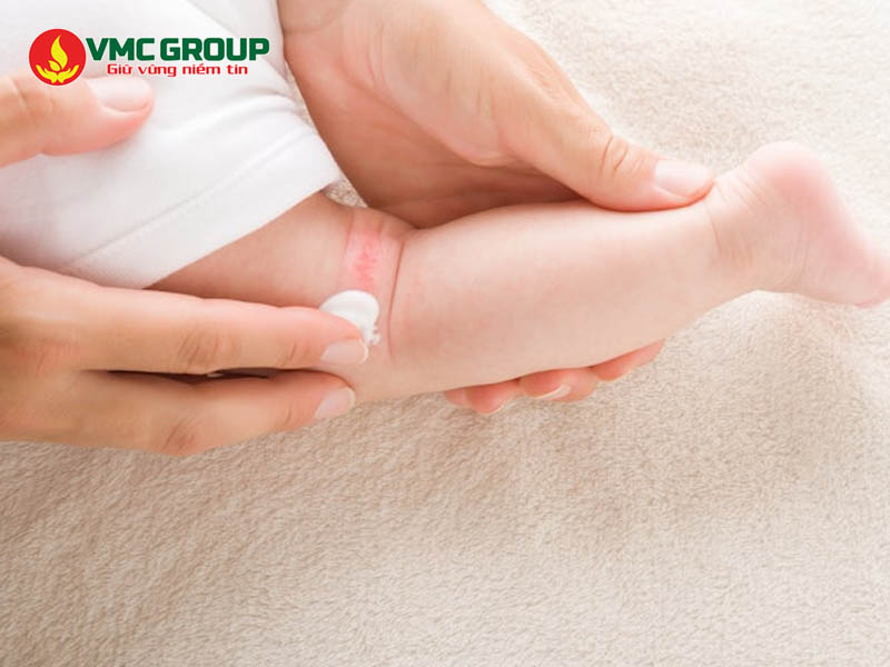 Ứng dụng của Zinc Oxide trong y tế